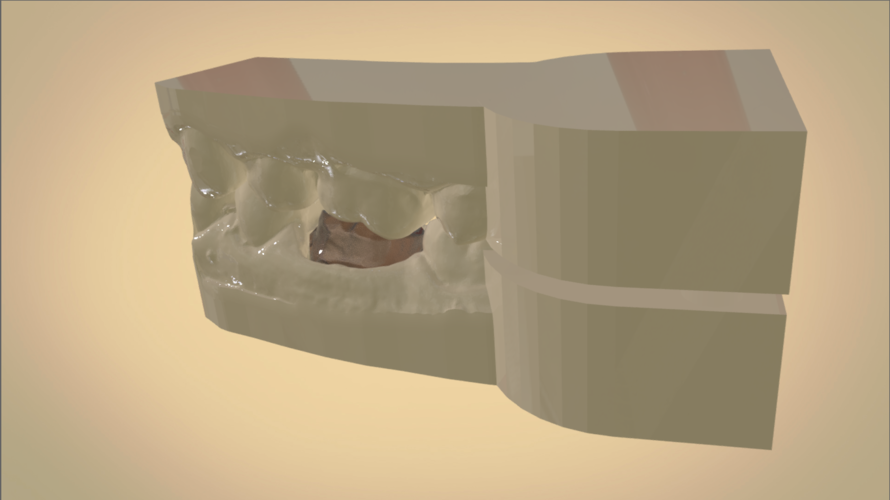 Digital Dental Quadrant Model 3D Print 192161 Digital Dental Quadrant Model 3D Print 192161