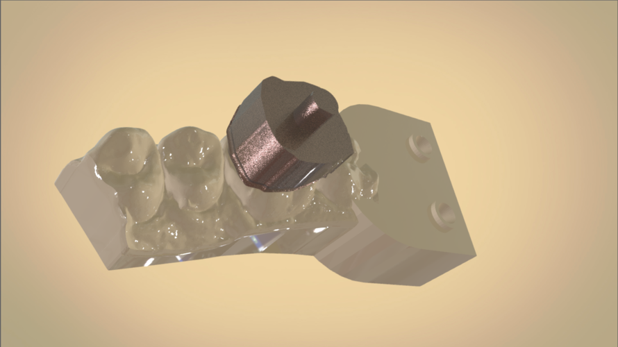 Digital Dental Quadrant Model 3D Print 192163 Digital Dental Quadrant Model 3D Print 192163