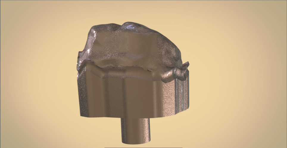 Digital Dental Quadrant Model 3D Print 192164 Digital Dental Quadrant Model 3D Print 192164