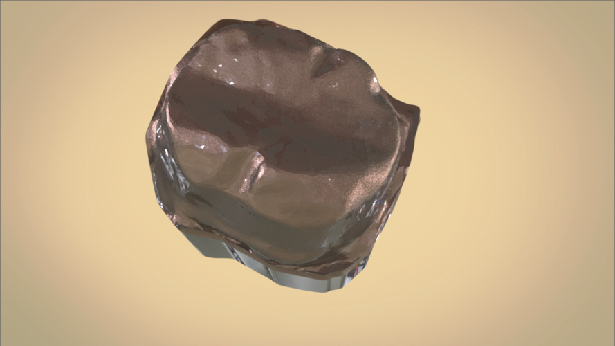Digital Dental Quadrant Model 3D Print 192165 Digital Dental Quadrant Model 3D Print 192165