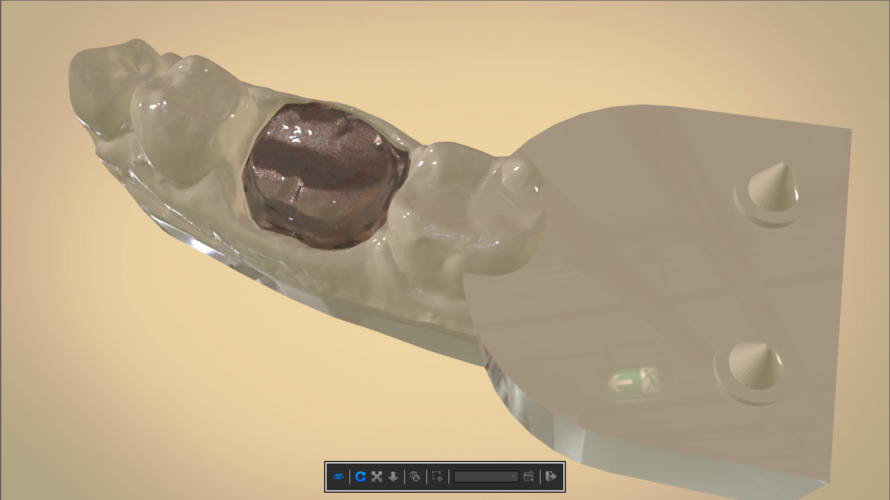 Digital Dental Quadrant Model 3D Print 192166 Digital Dental Quadrant Model 3D Print 192166