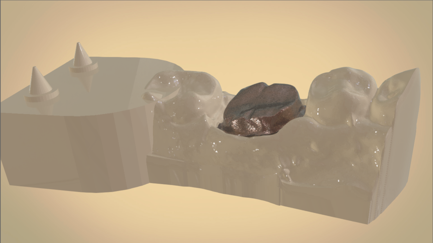 Digital Dental Quadrant Model 3D Print 192167 Digital Dental Quadrant Model 3D Print 192167