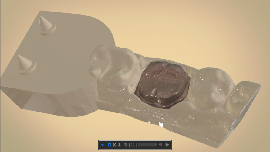 Digital Dental Quadrant Model 3D Print 192168 Digital Dental Quadrant Model 3D Print 192168