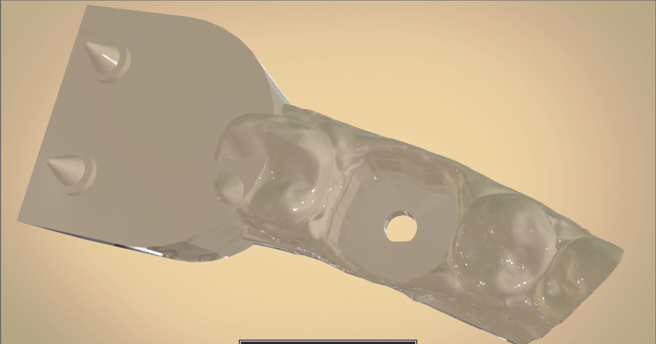Digital Dental Quadrant Model 3D Print 192170 Digital Dental Quadrant Model 3D Print 192170