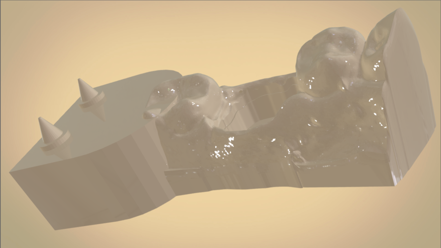 Digital Dental Quadrant Model 3D Print 192171 Digital Dental Quadrant Model 3D Print 192171