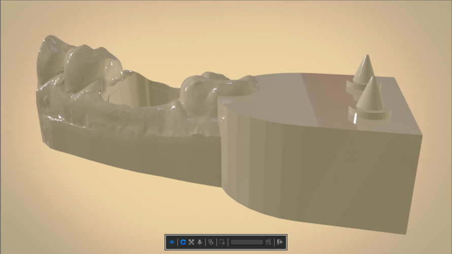 Digital Dental Quadrant Model 3D Print 192172 Digital Dental Quadrant Model 3D Print 192172