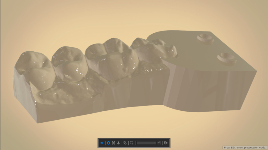 Digital Dental Quadrant Model 3D Print 192173 Digital Dental Quadrant Model 3D Print 192173