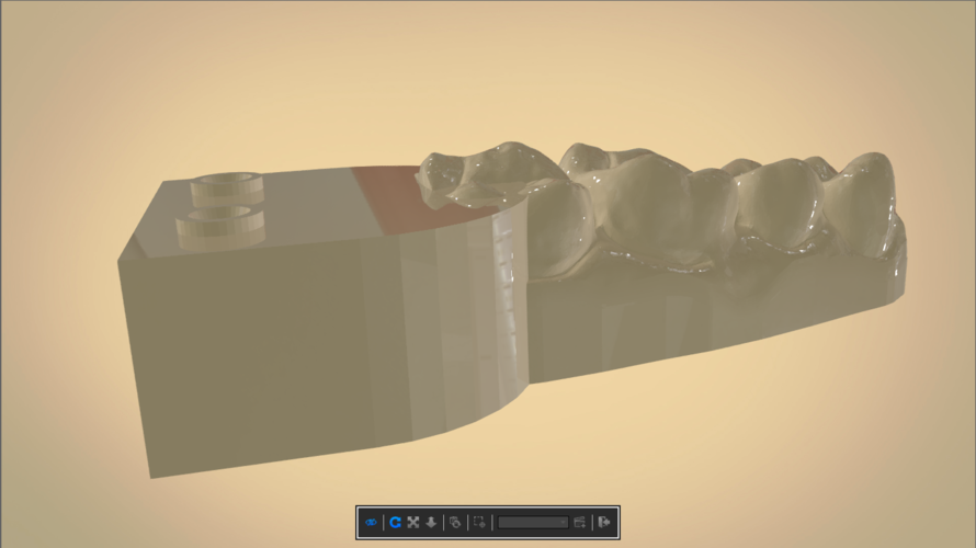 Digital Dental Quadrant Model 3D Print 192174 Digital Dental Quadrant Model 3D Print 192174