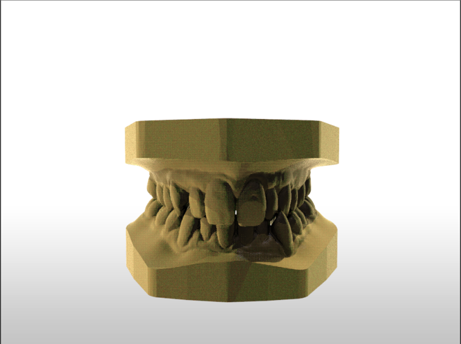 Digital Study Orthodontic Models with Archman Virtual Bases 3D Print 193986 Digital Study Orthodontic Models with Archman Virtual Bases 3D Print 193986