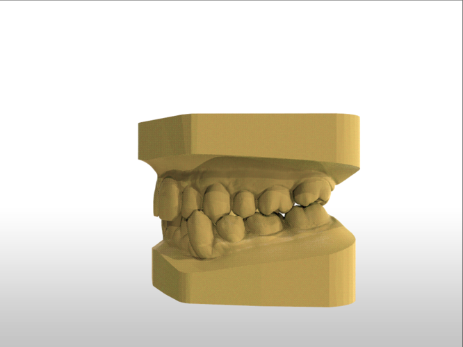 Digital Study Orthodontic Models with Archman Virtual Bases 3D Print 193988 Digital Study Orthodontic Models with Archman Virtual Bases 3D Print 193988