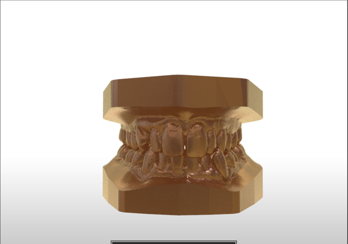 Digital Study Orthodontic Models with Archman Virtual Bases 3D Print 193990 Digital Study Orthodontic Models with Archman Virtual Bases 3D Print 193990