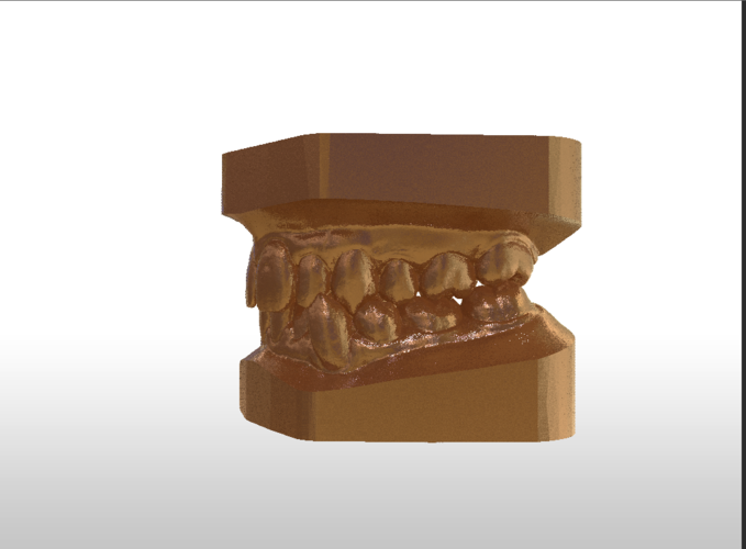 Digital Study Orthodontic Models with Archman Virtual Bases 3D Print 193991 Digital Study Orthodontic Models with Archman Virtual Bases 3D Print 193991
