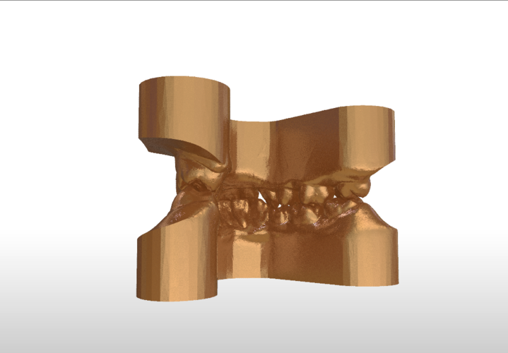Digital Study Orthodontic Models with Archman Virtual Bases 3D Print 193992 Digital Study Orthodontic Models with Archman Virtual Bases 3D Print 193992