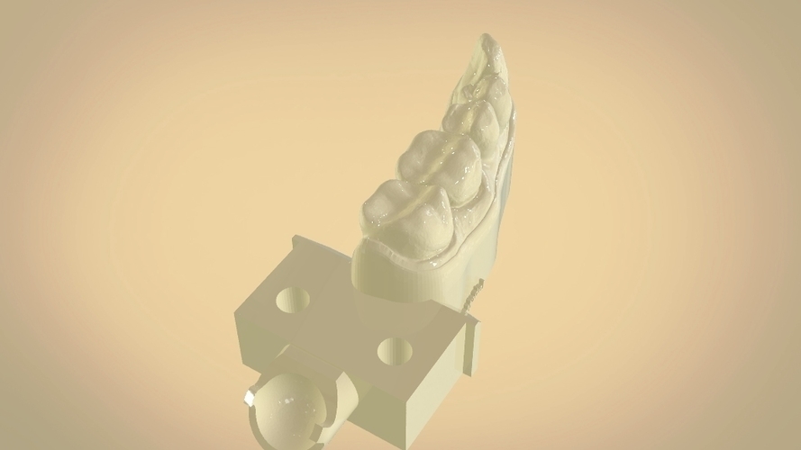 Digital Dental Quadrant Model with a Full Contour Crown 3D Print 199158 Digital Dental Quadrant Model with a Full Contour Crown 3D Print 199158