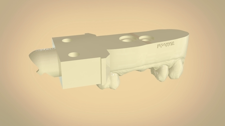 Digital Dental Quadrant Model with a Full Contour Crown 3D Print 199159 Digital Dental Quadrant Model with a Full Contour Crown 3D Print 199159