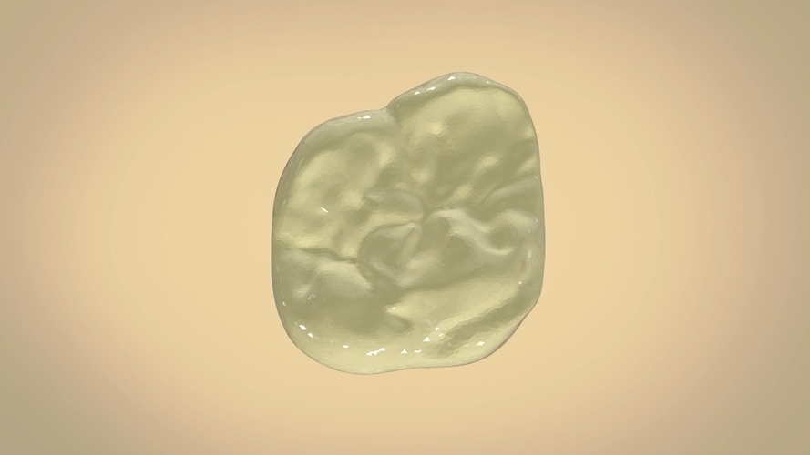 Digital Dental Quadrant Model with a Full Contour Crown 3D Print 199169 Digital Dental Quadrant Model with a Full Contour Crown 3D Print 199169