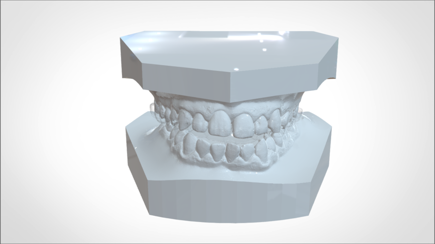 Digital KOIS Styled Nightguard 3D Print 205767 Digital KOIS Styled Nightguard 3D Print 205767