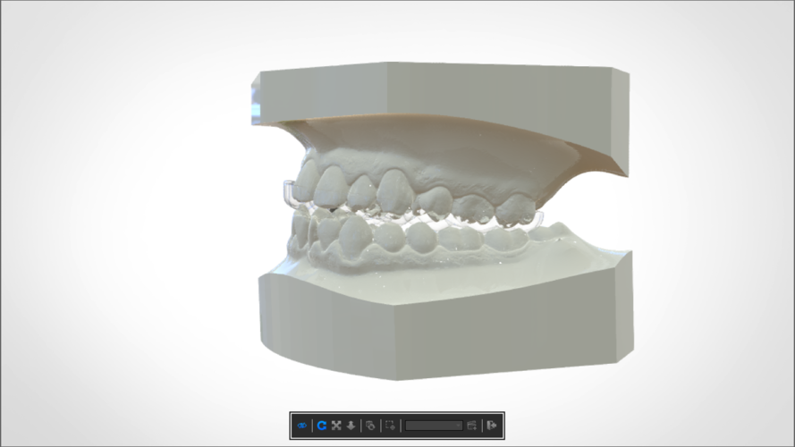 Digital KOIS Styled Nightguard 3D Print 205769 Digital KOIS Styled Nightguard 3D Print 205769