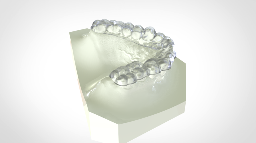 Digital KOIS Styled Nightguard 3D Print 205770 Digital KOIS Styled Nightguard 3D Print 205770