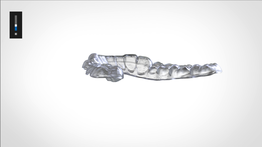 Digital Mandibular Nightguard 3D Print 207178 Digital Mandibular Nightguard 3D Print 207178