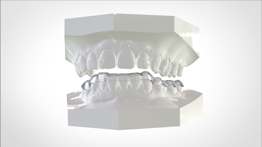 Digital Mandibular Nightguard 3D Print 207179 Digital Mandibular Nightguard 3D Print 207179