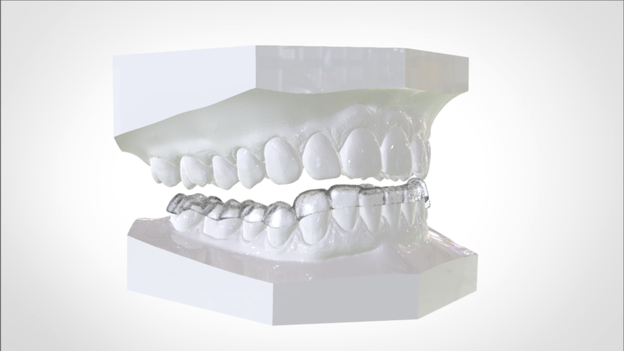 Digital Mandibular Nightguard 3D Print 207180 Digital Mandibular Nightguard 3D Print 207180
