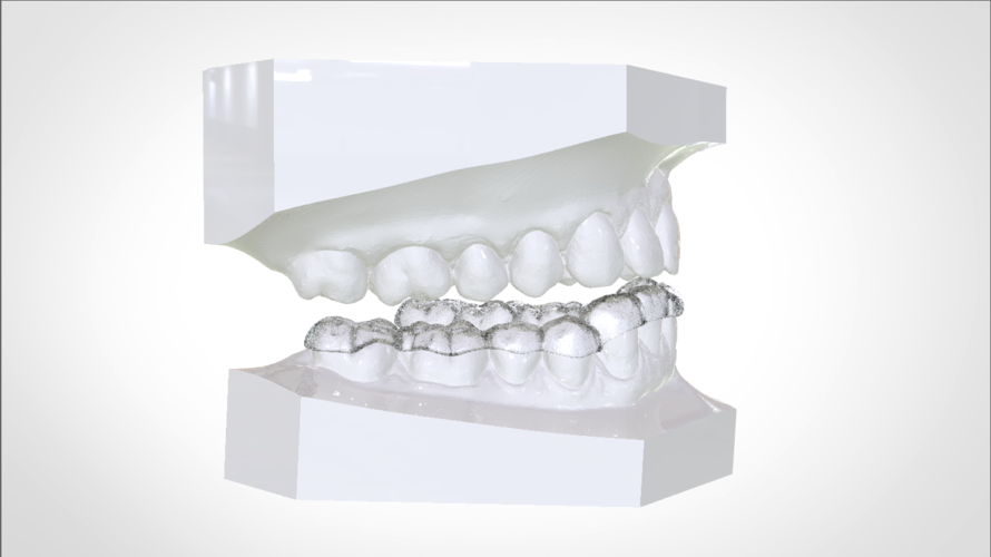 Digital Mandibular Nightguard 3D Print 207181 Digital Mandibular Nightguard 3D Print 207181