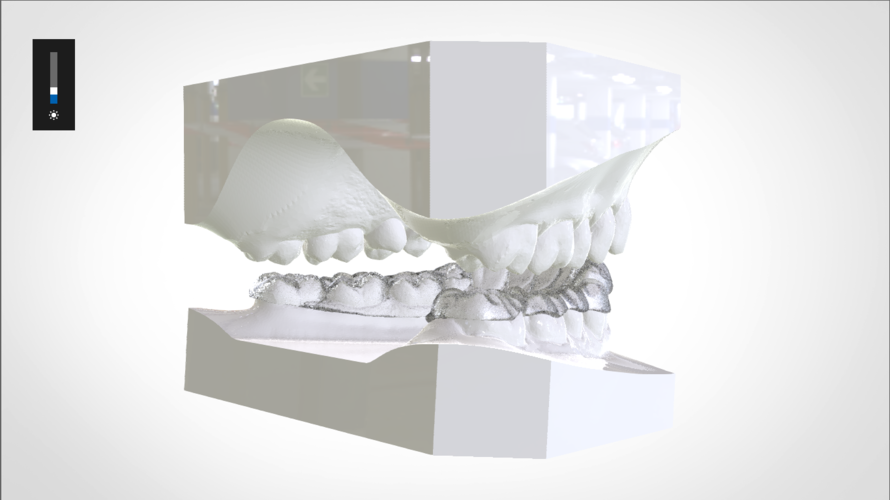 Digital Mandibular Nightguard 3D Print 207182 Digital Mandibular Nightguard 3D Print 207182