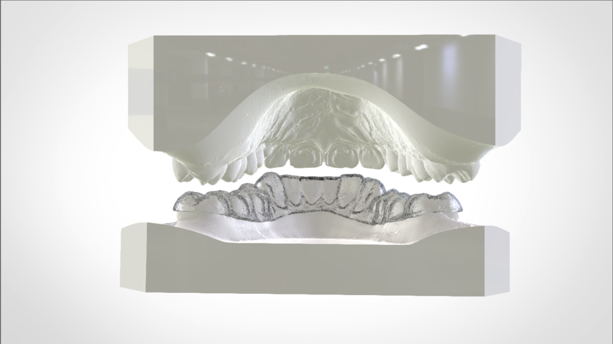 Digital Mandibular Nightguard 3D Print 207183 Digital Mandibular Nightguard 3D Print 207183