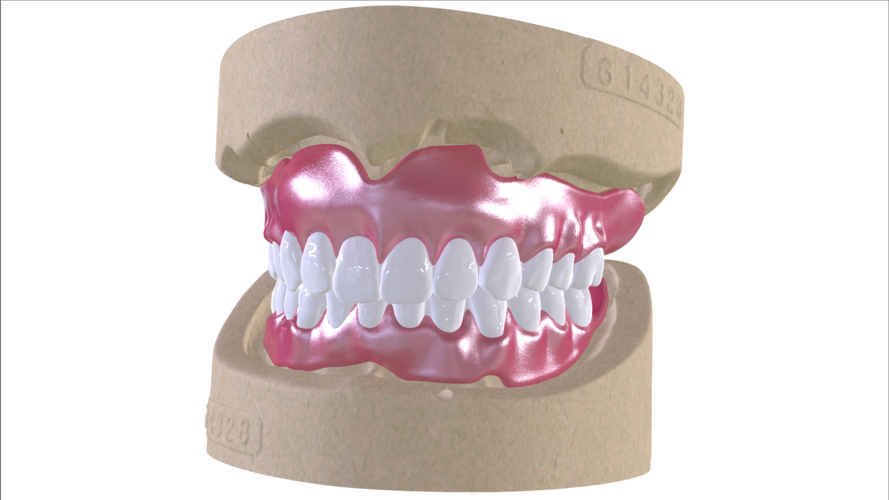 Digital Full Dentures with Combined Glue-in Teeth Arch 3D Print 221681 Digital Full Dentures with Combined Glue-in Teeth Arch 3D Print 221681