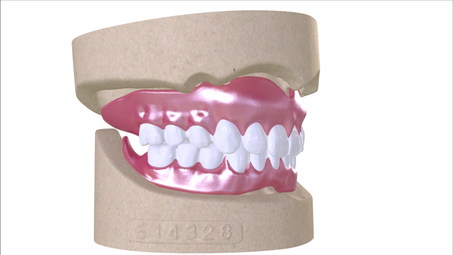Digital Full Dentures with Combined Glue-in Teeth Arch 3D Print 221682 Digital Full Dentures with Combined Glue-in Teeth Arch 3D Print 221682