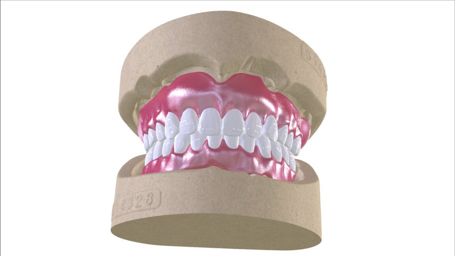 Digital Full Dentures with Combined Glue-in Teeth Arch 3D Print 221684 Digital Full Dentures with Combined Glue-in Teeth Arch 3D Print 221684