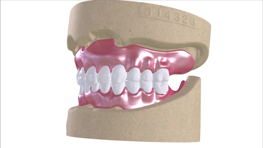 Digital Full Dentures with Combined Glue-in Teeth Arch 3D Print 221685 Digital Full Dentures with Combined Glue-in Teeth Arch 3D Print 221685