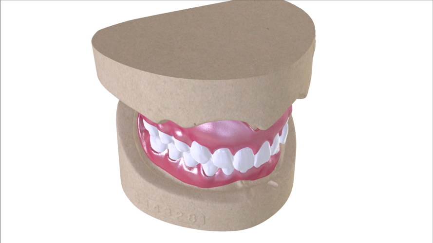 Digital Full Dentures with Combined Glue-in Teeth Arch 3D Print 221686 Digital Full Dentures with Combined Glue-in Teeth Arch 3D Print 221686
