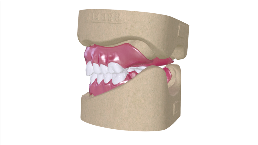 Digital Full Dentures with Combined Glue-in Teeth Arch 3D Print 221688 Digital Full Dentures with Combined Glue-in Teeth Arch 3D Print 221688