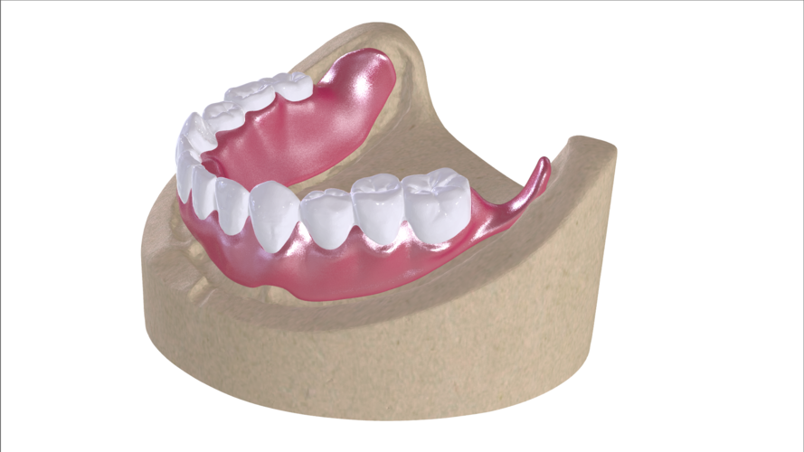 Digital Full Dentures with Combined Glue-in Teeth Arch 3D Print 221690 Digital Full Dentures with Combined Glue-in Teeth Arch 3D Print 221690