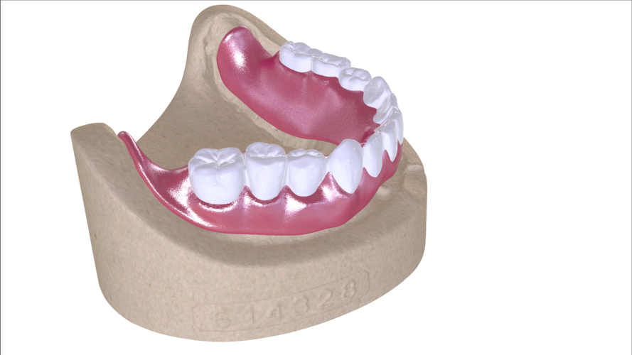 Digital Full Dentures with Combined Glue-in Teeth Arch 3D Print 221691 Digital Full Dentures with Combined Glue-in Teeth Arch 3D Print 221691