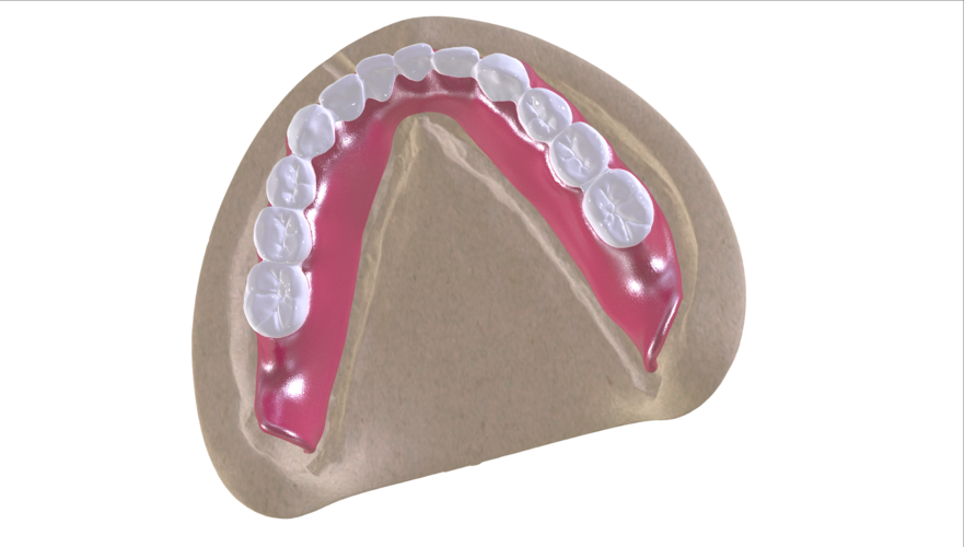 Digital Full Dentures with Combined Glue-in Teeth Arch 3D Print 221692 Digital Full Dentures with Combined Glue-in Teeth Arch 3D Print 221692