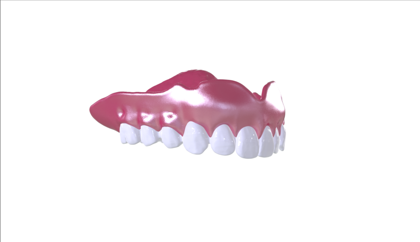 Digital Full Dentures with Combined Glue-in Teeth Arch 3D Print 221693 Digital Full Dentures with Combined Glue-in Teeth Arch 3D Print 221693