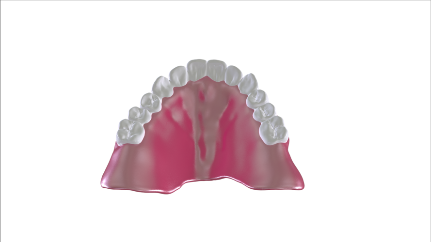 Digital Full Dentures with Combined Glue-in Teeth Arch 3D Print 221694 Digital Full Dentures with Combined Glue-in Teeth Arch 3D Print 221694