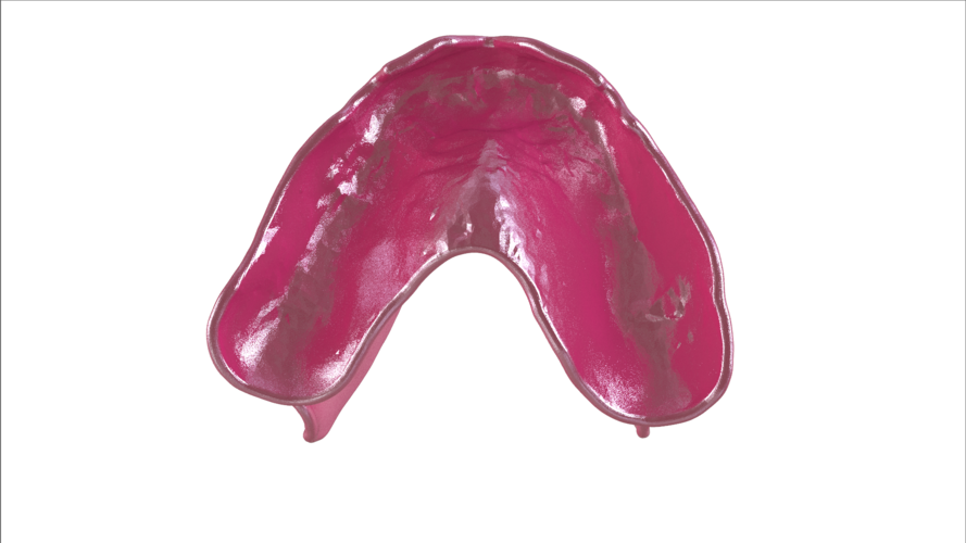 Digital Full Dentures with Combined Glue-in Teeth Arch 3D Print 221695 Digital Full Dentures with Combined Glue-in Teeth Arch 3D Print 221695