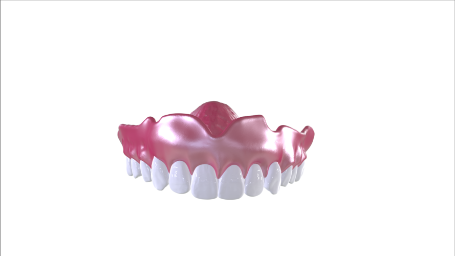 Digital Full Dentures with Combined Glue-in Teeth Arch 3D Print 221696 Digital Full Dentures with Combined Glue-in Teeth Arch 3D Print 221696