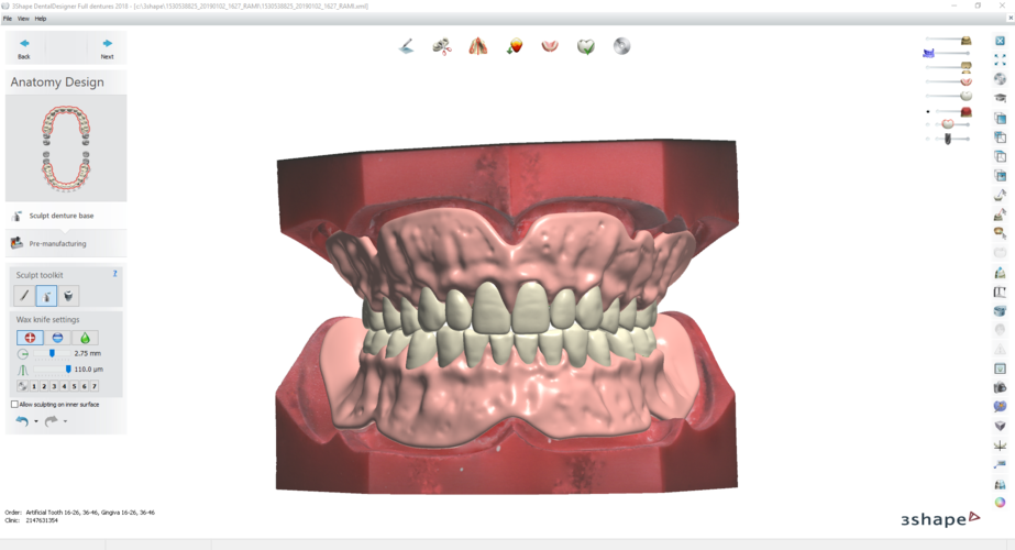 Digital Try-in Full Dentures for Injection Molding 3D Print 223589 Digital Try-in Full Dentures for Injection Molding 3D Print 223589