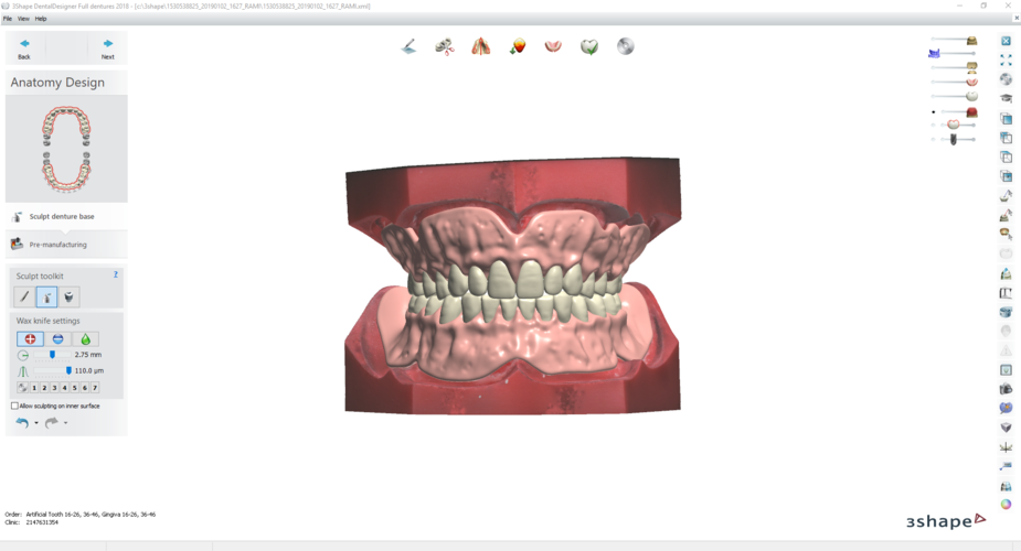 Digital Try-in Full Dentures for Injection Molding 3D Print 223590 Digital Try-in Full Dentures for Injection Molding 3D Print 223590