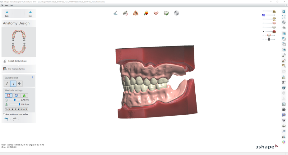 Digital Try-in Full Dentures for Injection Molding 3D Print 223591 Digital Try-in Full Dentures for Injection Molding 3D Print 223591