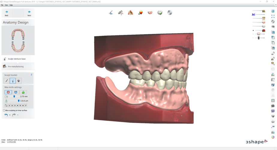 Digital Try-in Full Dentures for Injection Molding 3D Print 223592 Digital Try-in Full Dentures for Injection Molding 3D Print 223592