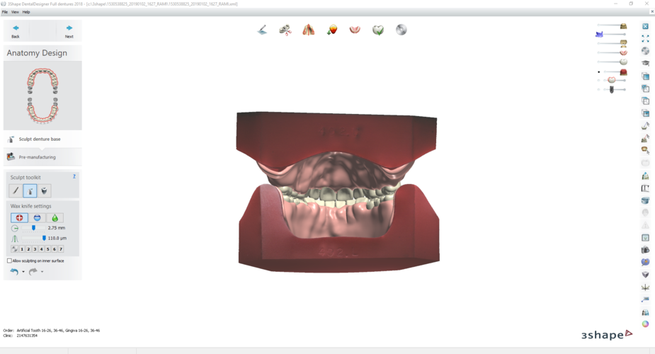 Digital Try-in Full Dentures for Injection Molding 3D Print 223593 Digital Try-in Full Dentures for Injection Molding 3D Print 223593