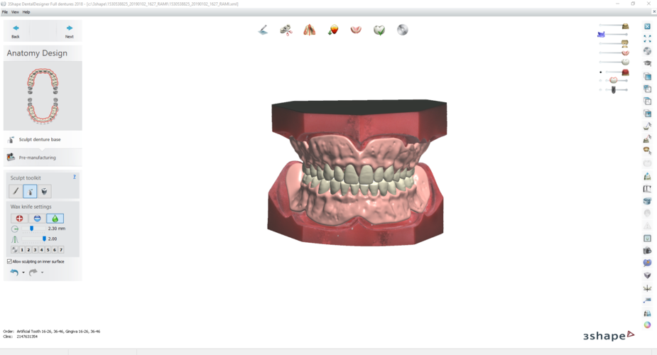 Digital Try-in Full Dentures for Injection Molding 3D Print 223594 Digital Try-in Full Dentures for Injection Molding 3D Print 223594