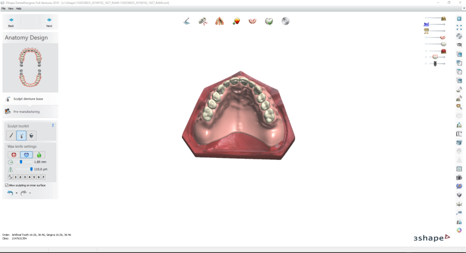 Digital Try-in Full Dentures for Injection Molding 3D Print 223595 Digital Try-in Full Dentures for Injection Molding 3D Print 223595