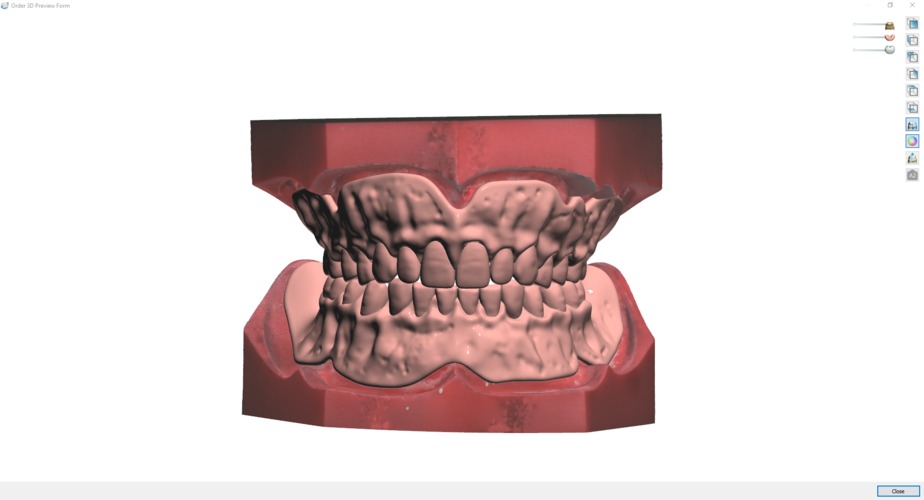 Digital Try-in Full Dentures for Injection Molding 3D Print 223596 Digital Try-in Full Dentures for Injection Molding 3D Print 223596